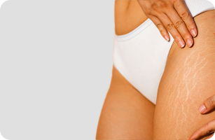 Zoom sur les rides et ridules d'une femme
